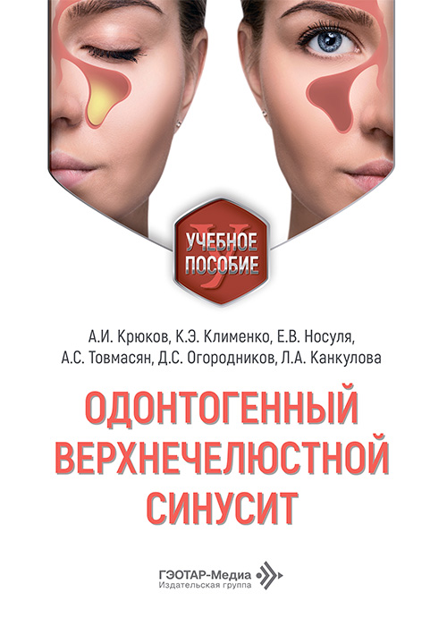 Одонтогенный верхнечелюстной синусит. Учебное пособие (эл.версия)