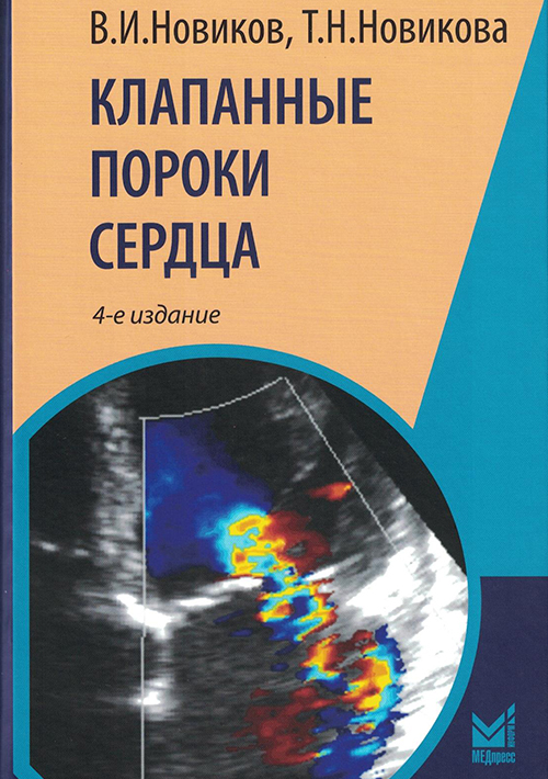 Клапанные пороки сердца