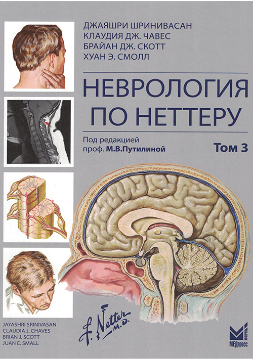 NF0034366