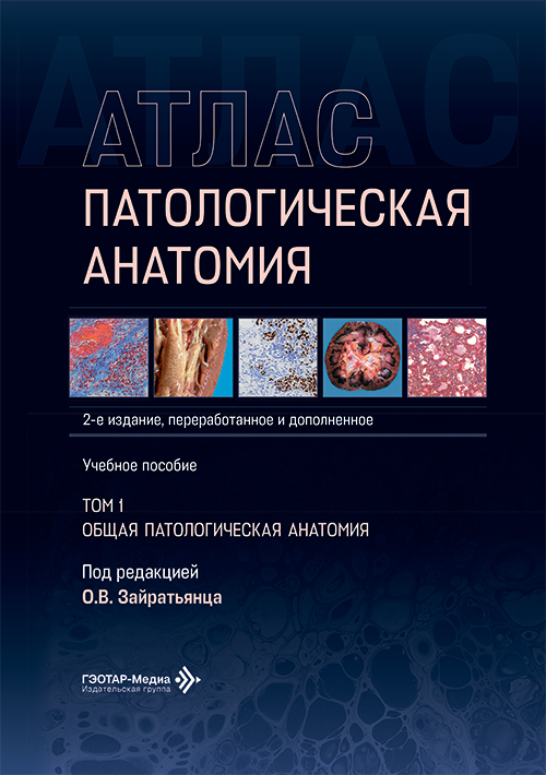 Патологическая анатомия. Атлас. Учебное пособие в 2-х томах. Том 1. Общая патологическая анатомия