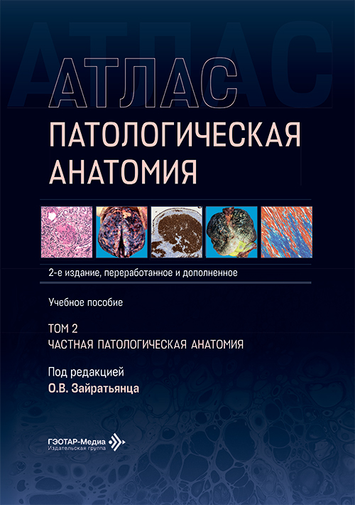 Патологическая анатомия. Атлас. Частная патологическая анатомия. В 2-х томах. Том 2