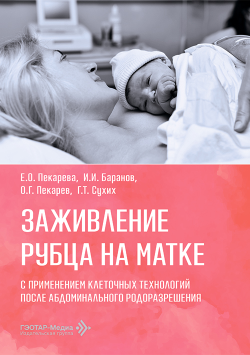 Заживление рубца на матке с применением клеточных технологий после абдоминального родоразрешения (электронное издание)