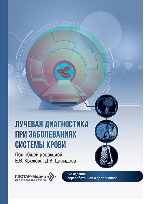 Лучевая диагностика при заболеваниях системы крови (эл.версия)