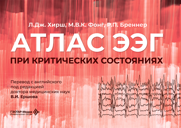 Атлас ЭЭГ при критических состояниях