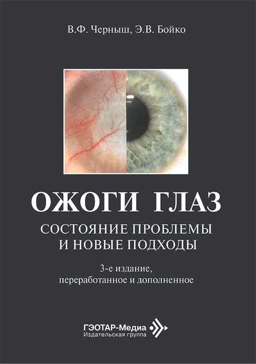 Ожоги глаз. Состояние проблемы и новые подходы (читать на сайте эл.версию)