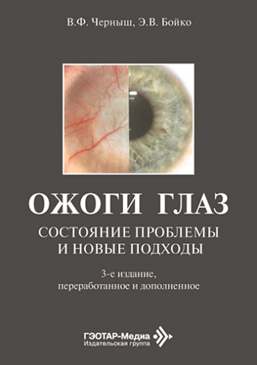 Ожоги глаз. Состояние проблемы и новые подходы