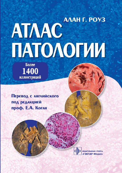 Атлас патологии. Макро- и микроскопические изменения органов (уценка 20)