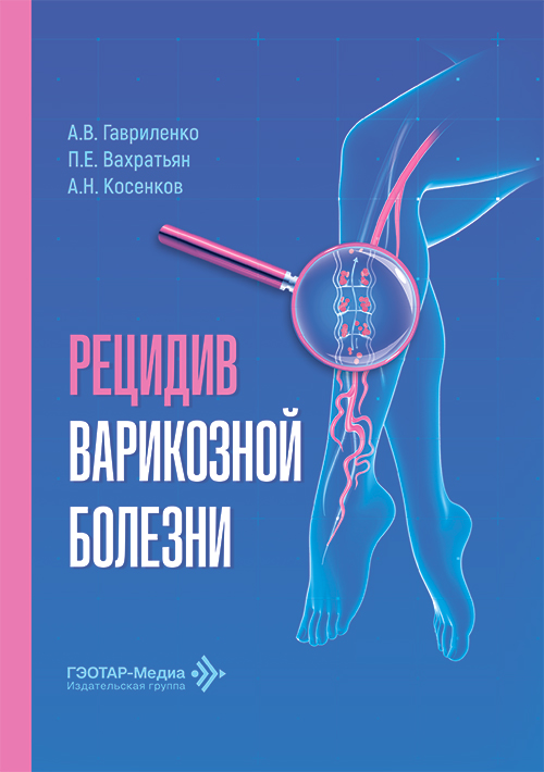 Рецидив варикозной болезни (читать на сайте эл.версию)