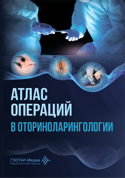Атлас операций в оториноларингологии (читать на сайте эл.версию)