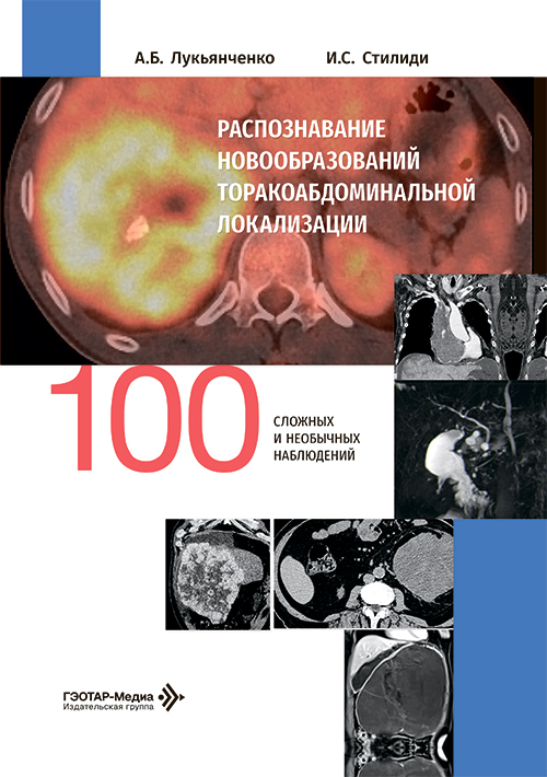 Распознавание новообразований торако-абдоминальной локализации: 100 сложных и необычных наблюдений (читать на сайте эл.версию)