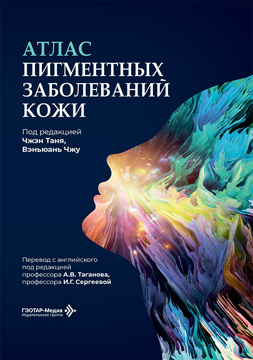 Атлас пигментных заболеваний кожи