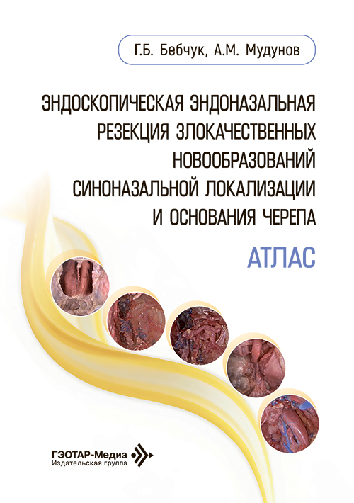 Эндоскопическая эндоназальная резекция злокачественных новообразований синоназальной локализации и основания черепа. Атлас